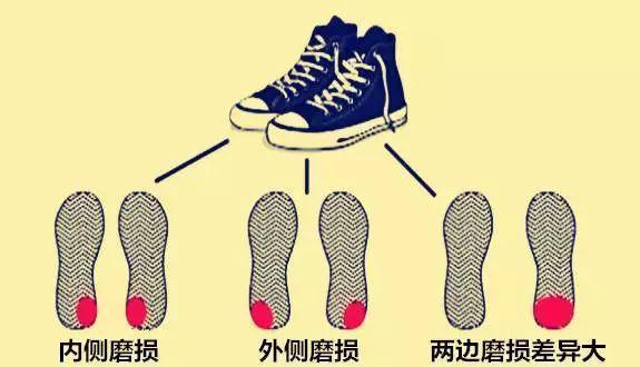 鞋子磨损