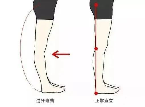 腿站立对比图