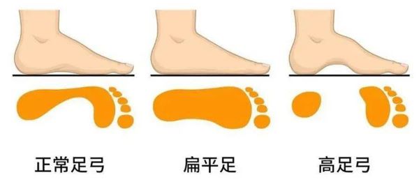 足部对比图