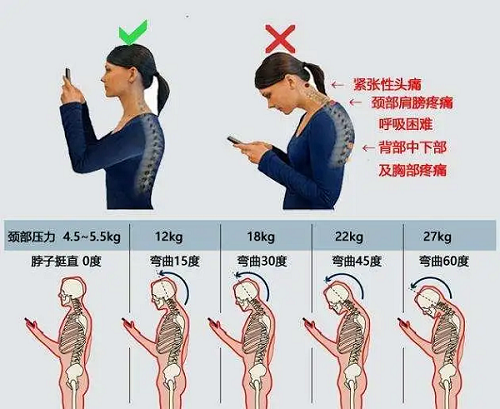 颈部压力