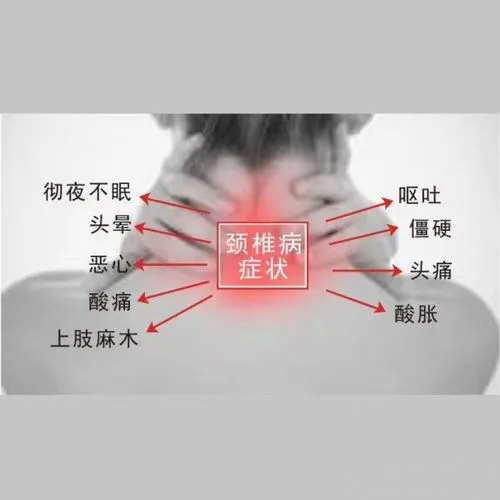 颈椎病症状