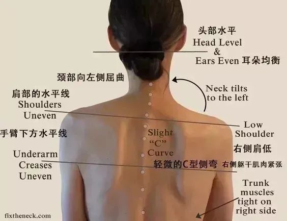 高低肩