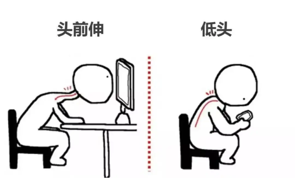 颈椎不良姿势