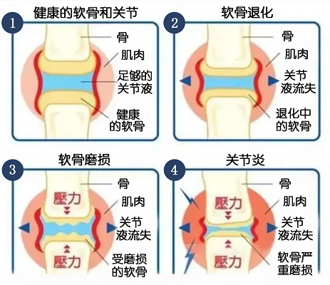 关节变化过程