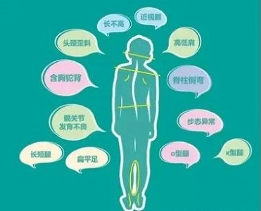 脊柱侧弯危害
