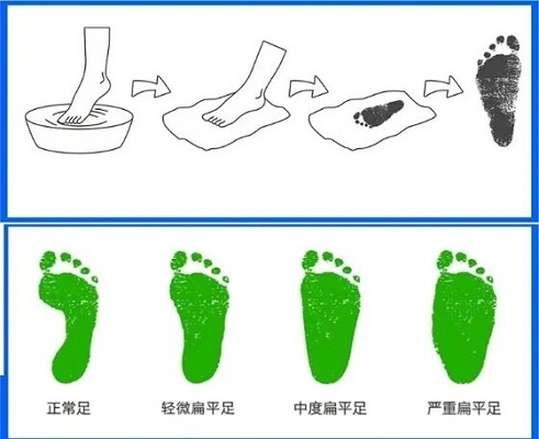 湿足印检测方法