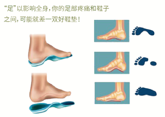直乐矫形鞋垫