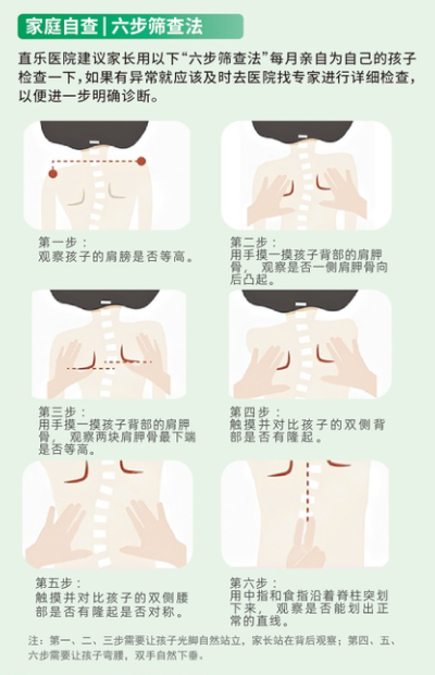 直乐医院脊柱侧弯六步筛查法