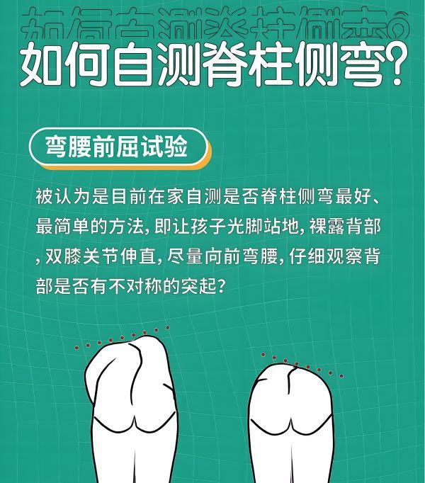脊柱侧弯自测方法