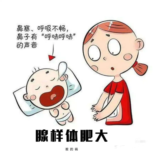 鼻塞张口呼吸