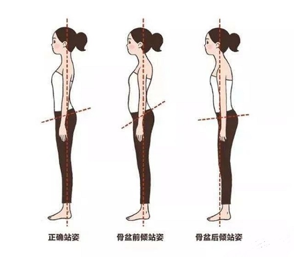 骨盆前倾后倾