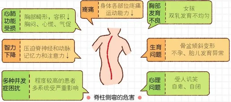 脊柱侧弯危害