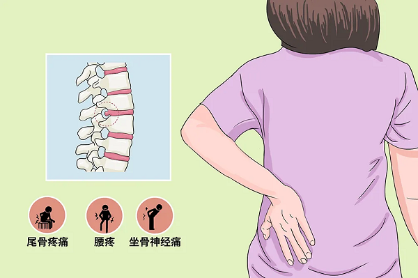 腰突症状