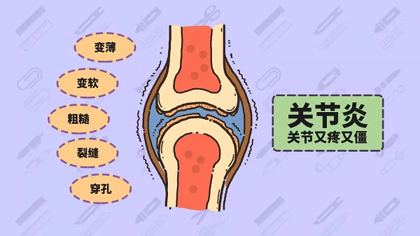 关节炎症状